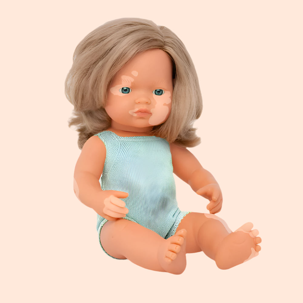 Vitiligo dolls