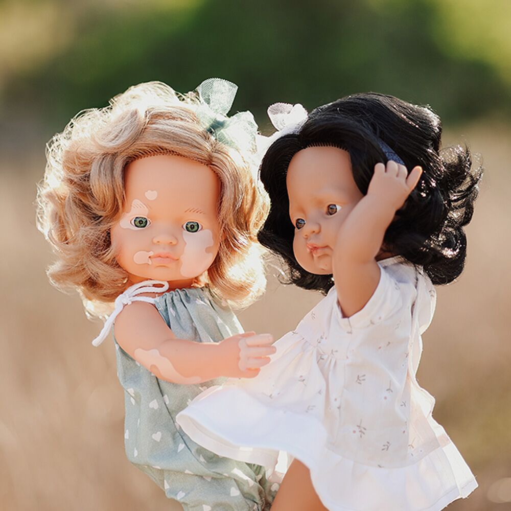 Inclusive Baby Doll with Vitiligo